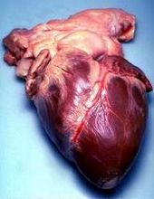 Human heart removed from a 64-year-old man.